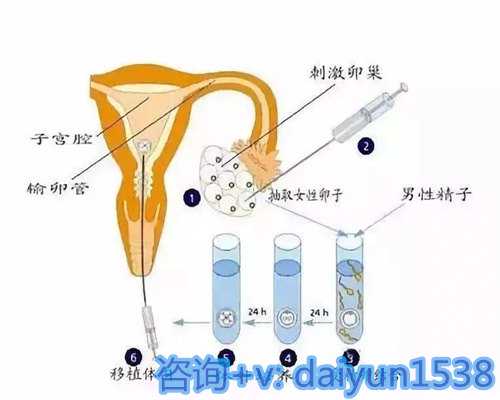 深圳靠谱辅助生殖:合法助孕机构与流程指南